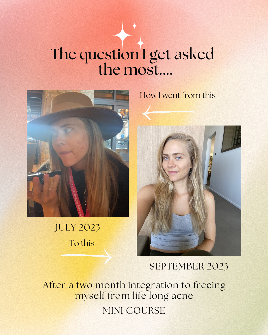 The Spiritual Guide to Acne MINI COURSE