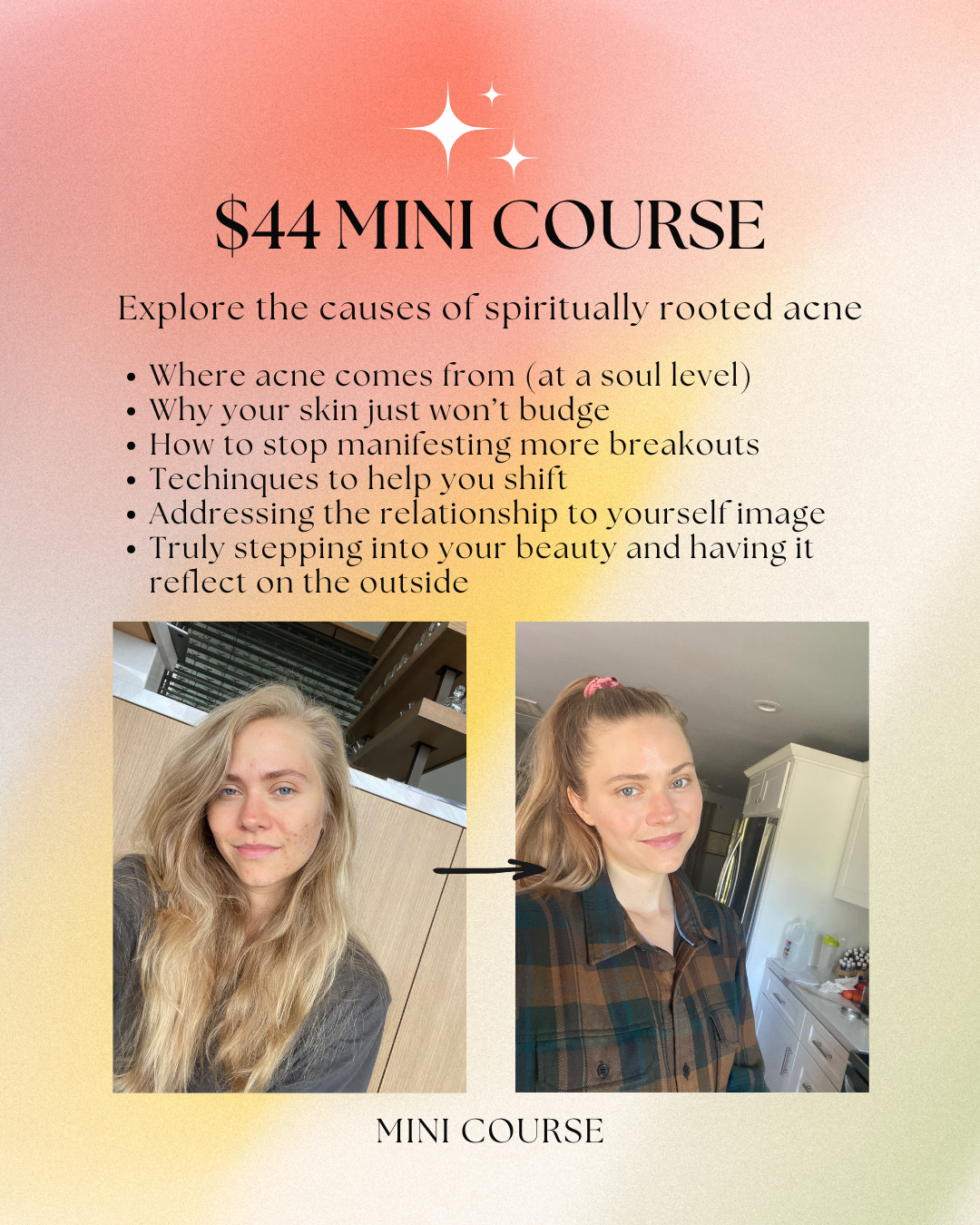 The Spiritual Guide to Acne MINI COURSE
